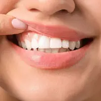 Gum-Surgery