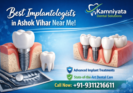 Best Implantologists in Ashok Vihar Near Me