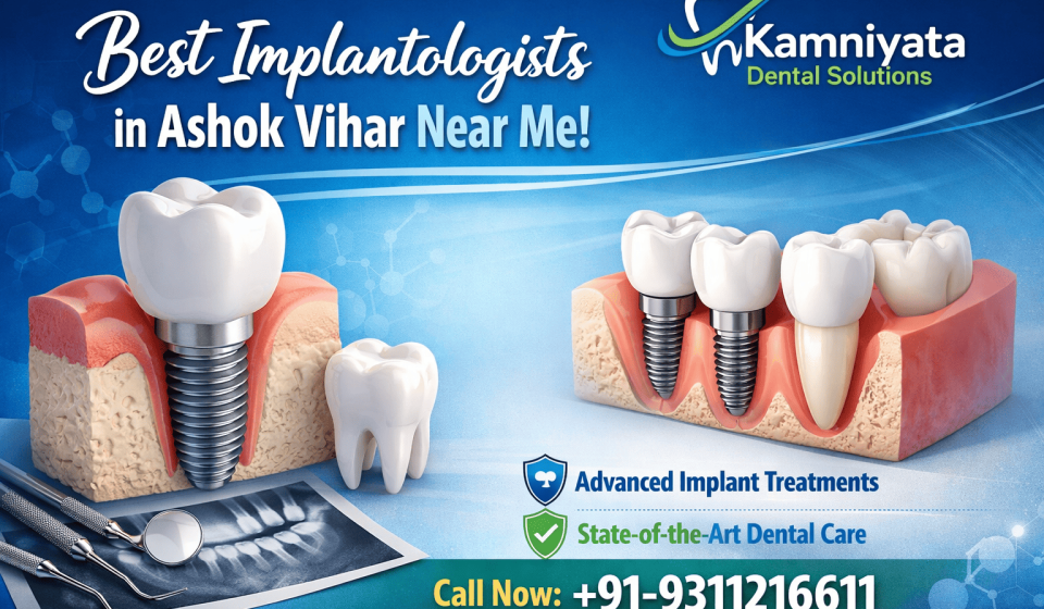 Best Implantologists in Ashok Vihar Near Me